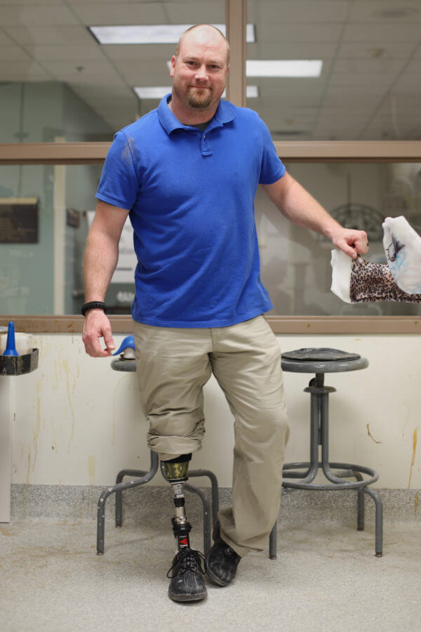 man with Prosthetic  leg
