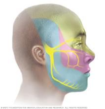 Illustration showing branches of the trigeminal nerve 
