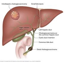 Places where cholangiocarcinoma, also called bile duct cancer, happens.