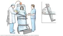 Illustration showing a tilt table test