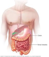 Illustration showing colon and small intestine