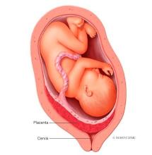 Placement of placenta and placenta previa