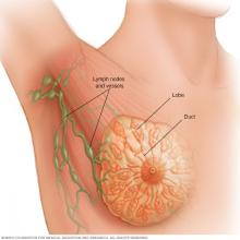 Illustration of breast anatomy showing the lymph nodes and vessels, lobe, and duct.