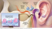 The inside of ear and damaged hairs