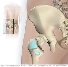 Hip bursae