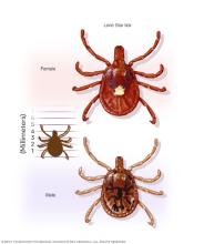 Lone Star tick