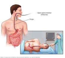 Illustration showing endoscopy
