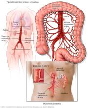 Typical mesenteric arterial circulation and mesenteric ischemia