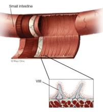 Small intestine lining and villi