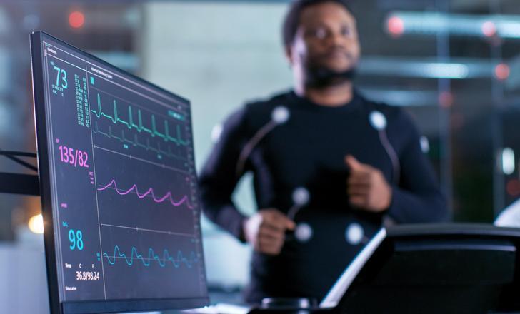 A petient running on a treadmill during a stress test and a heart monitor showing the stats.