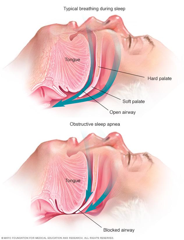 Soft tissues of the throat