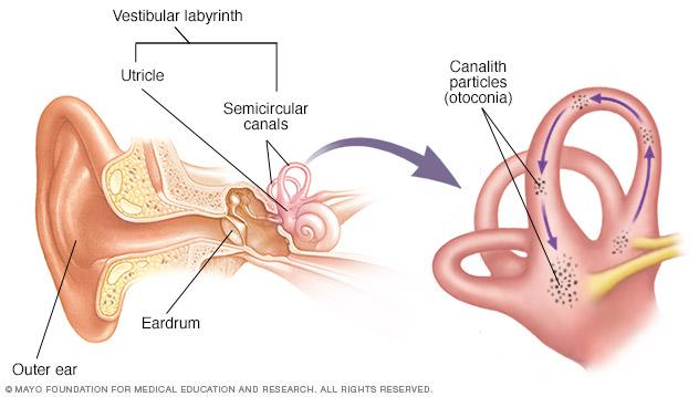 Inner ear and canalith repositioning