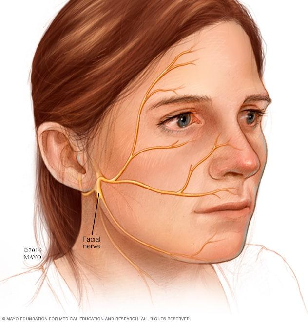 Nerves spread out from the base of the ear to above and below the eye, across the cheek and at the edge of the chin