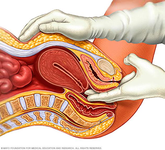 Illustration showing pelvic exam