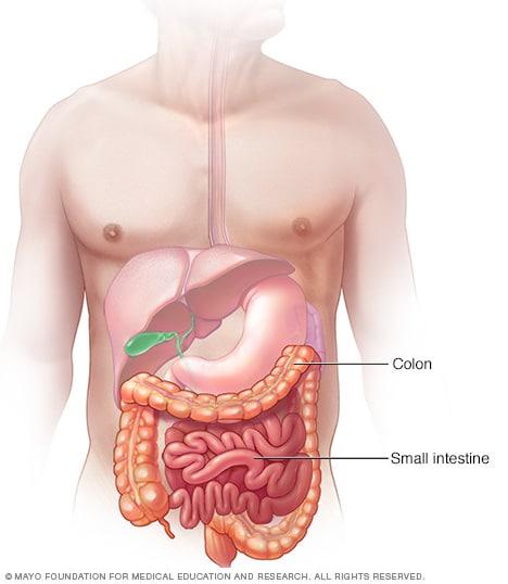 A view of the colon and small intestine