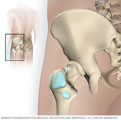 Hip bursae