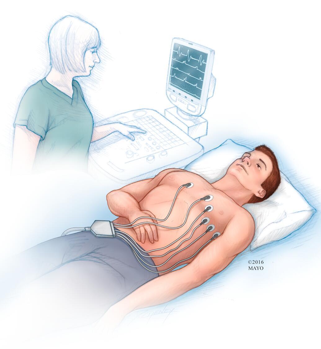 Electrocardiogram (ECG or EKG)