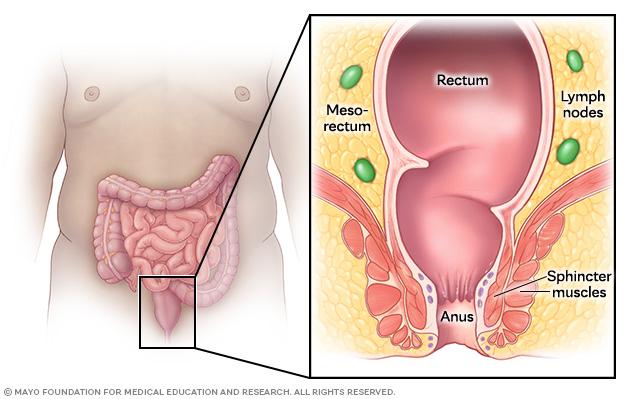Rectal anatomy, showing the rectum, anus, mesorectum, surrounding lymph nodes and sphincter muscles