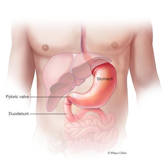 Illustration of stomach, pyloric valve and upper part of small intestine, called the duodenum